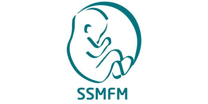 ssmfm